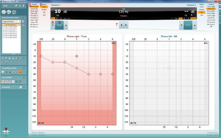 Diagnostic Suite Pure Tone Audiometry Interacoustics diagnostic-suite-pure-tone-audiometry-interacoustics